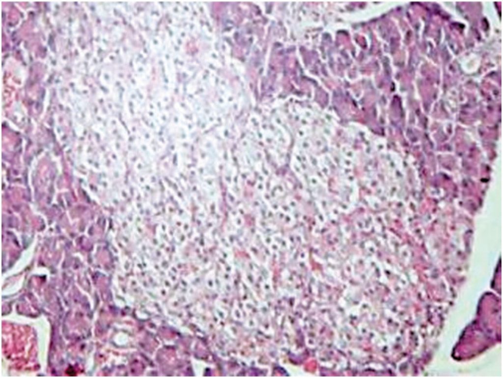 Chronic treatment with hydroalcoholic extract of Plathymenia reticulata